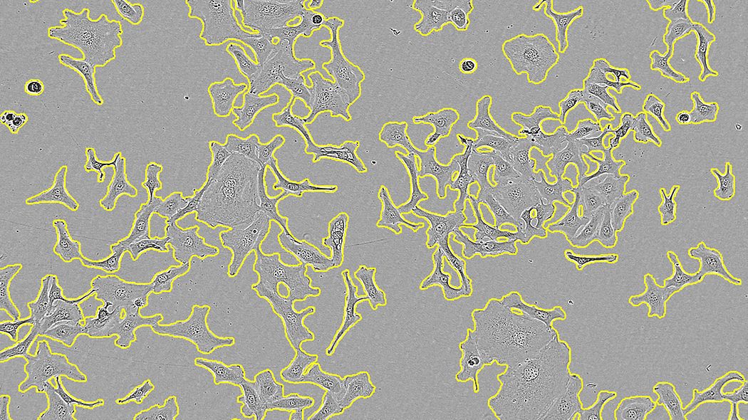 Incucyte® Base osnovni softverski modul za analizu stanica - Sartorius Croatia